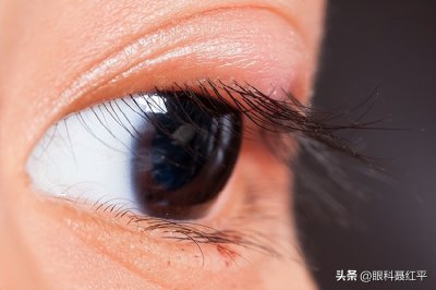​麦粒肿是什么原因引起（引起麦粒肿的原因有哪些）