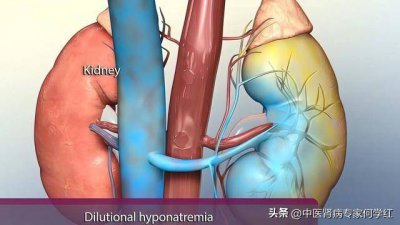 ​肌酐最怕的6种水果 肌酐高是什么原因造成的