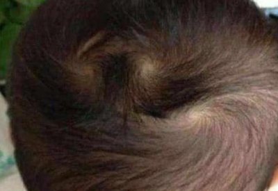 ​宝宝脑袋上头旋个数代表什么?原来是这样,父母别傻傻不清楚!