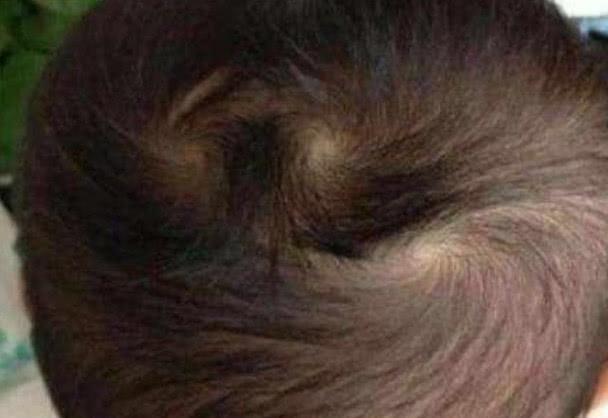 宝宝脑袋上头旋个数代表什么?原来是这样,父母别傻傻不清楚!