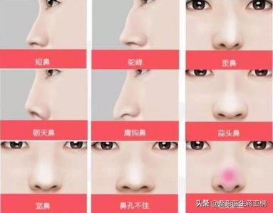 ​九种鼻型解析｜哪种鼻子是你理想鼻型？