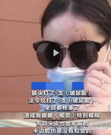 如何消除法令纹这几种方法很有效（法令纹出现了怎么消除）(6)