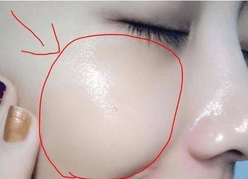 民间祛斑最有效的偏方（奶奶辈的祛斑秘方）(1)