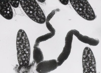 ​健康科普 | 白蛉的一生是怎样度过的？