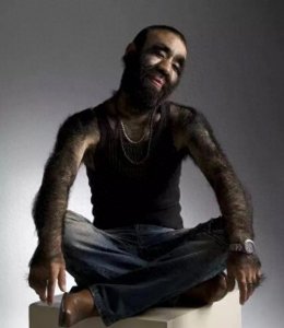 ​当年轰动一时的“毛孩”：42岁娶90后娇妻，生下一子未遗传长毛